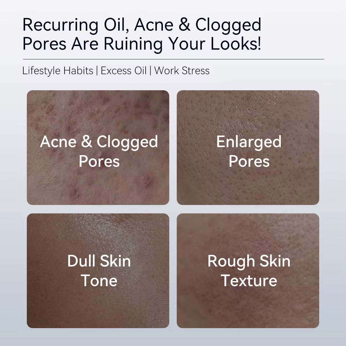 Pore Refining Toner – Oil Control & Skin Smoothing (120ml)