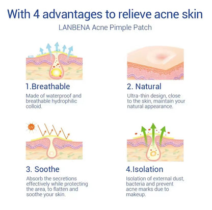 Night Acne Patches - 0.3mm (28pcs)