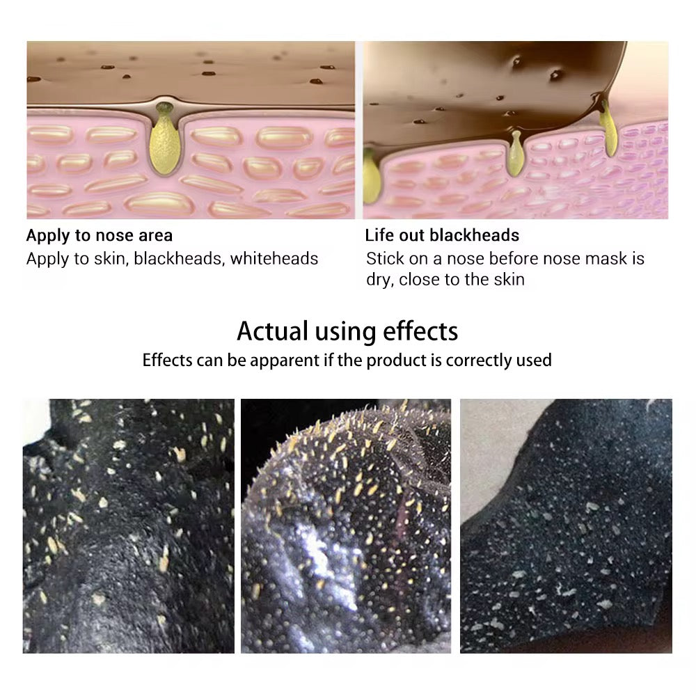 LANBENA Blackhead Remover Mask - 50g