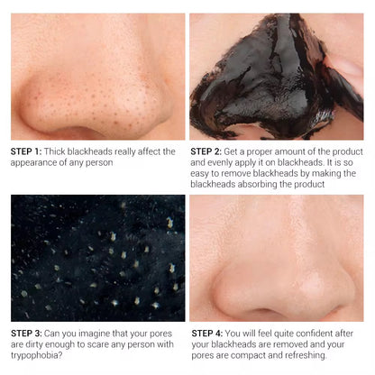 LANBENA Blackhead Remover Mask - 50g