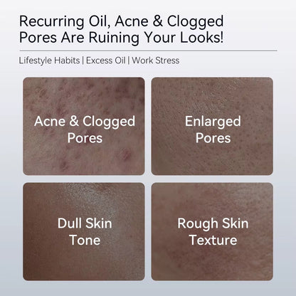 Pore Refining Toner – Oil Control & Skin Smoothing (120ml)
